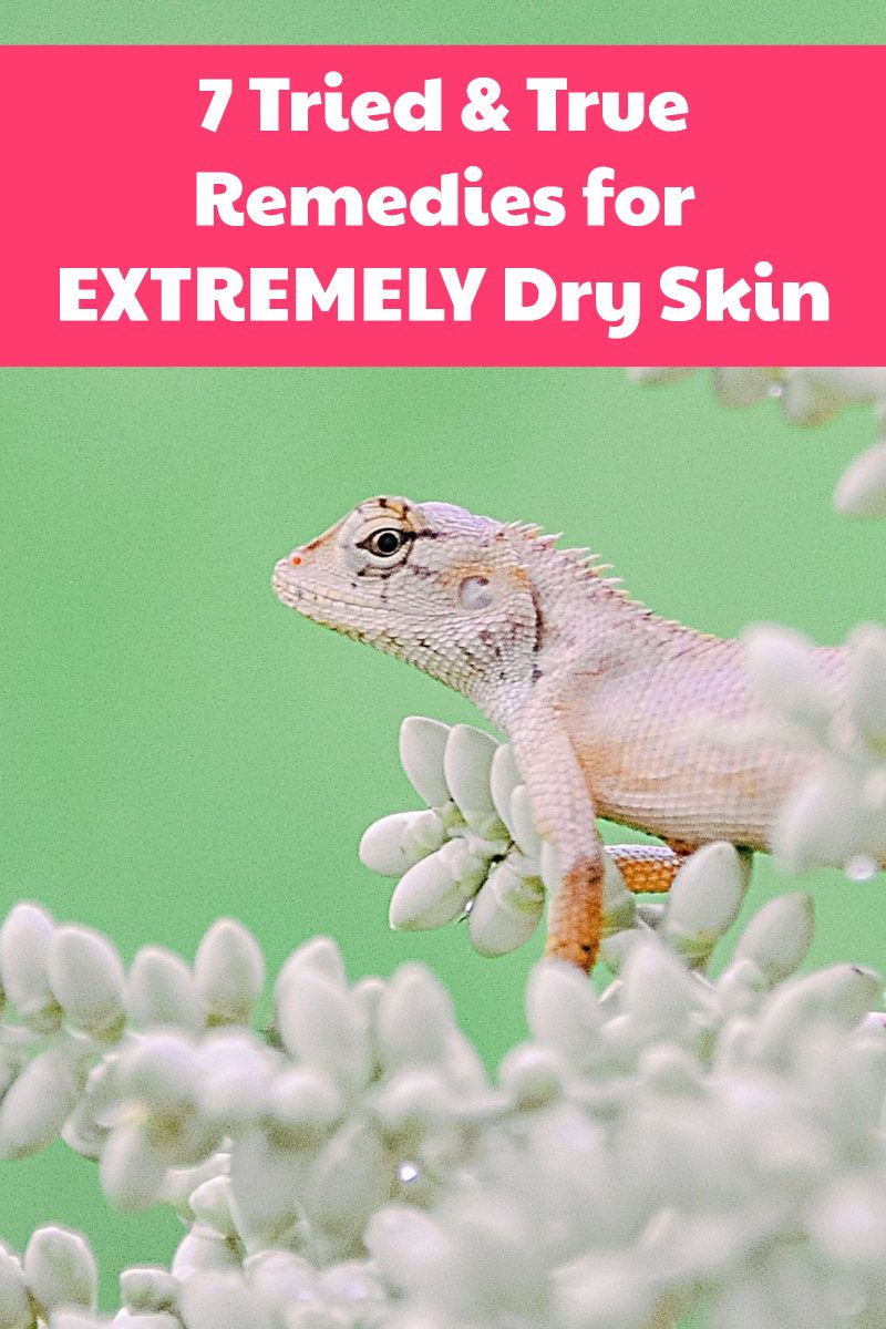 Dealing with extremely dry skin? Check out tried & true remedies of out what worked best, what kind of worked & what didn't work at all.
