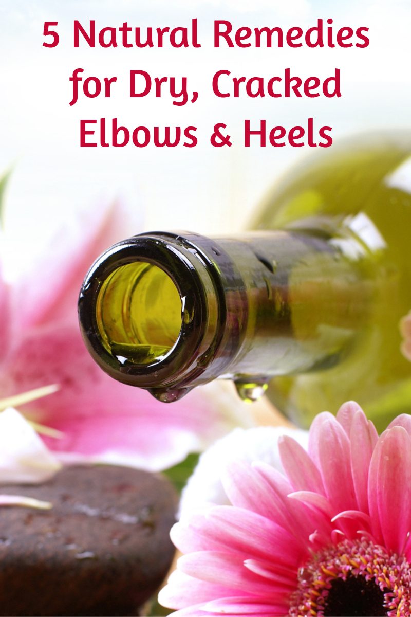 Don't let dry, cracked feet & elbows get you down! Check out these 5 natural and cheap home remedies! 