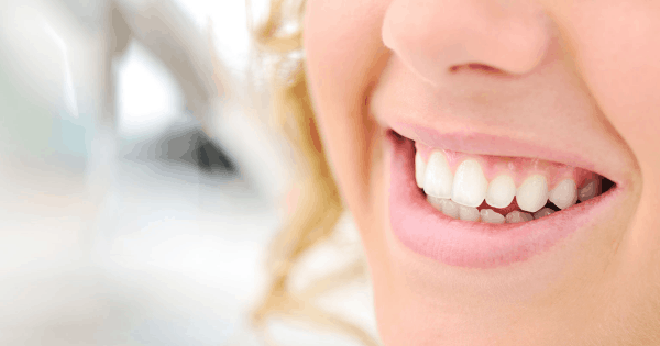 Why Should You Consider Invisalign?